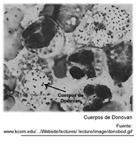 Calimatobacteria Donovani