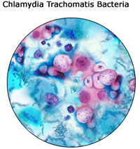 Chlamydia Trachomatis Bacteria