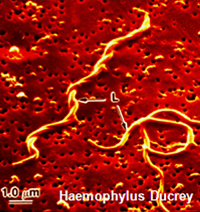 Haemophylus Ducrey