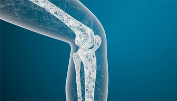 Tratamiento para la Osteoporosis en Guayaquil